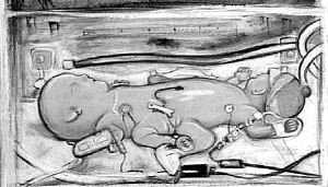 BRITAIN_SIAMESE_TWINS