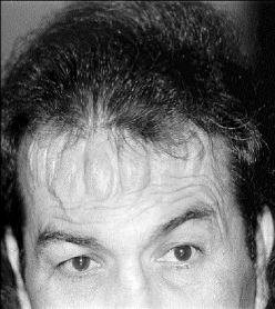 Ťfrente-perro-aguayo-lucha