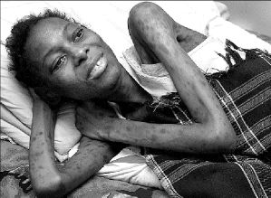 zimbabwe-victimas-sida-jpg